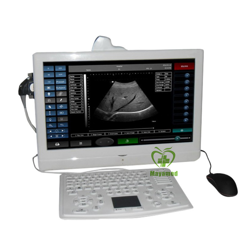 Escáner de ultrasonido portátil de alta frecuencia de diseño atractivo y popular, precio para Msk, nervio vascular 15MHz B36