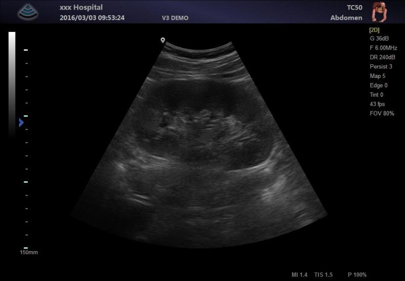 Ltub06 Todo Sistema de Diagnóstico Cardíaco Abdominal Digital por Ultrasonido con Doppler Color