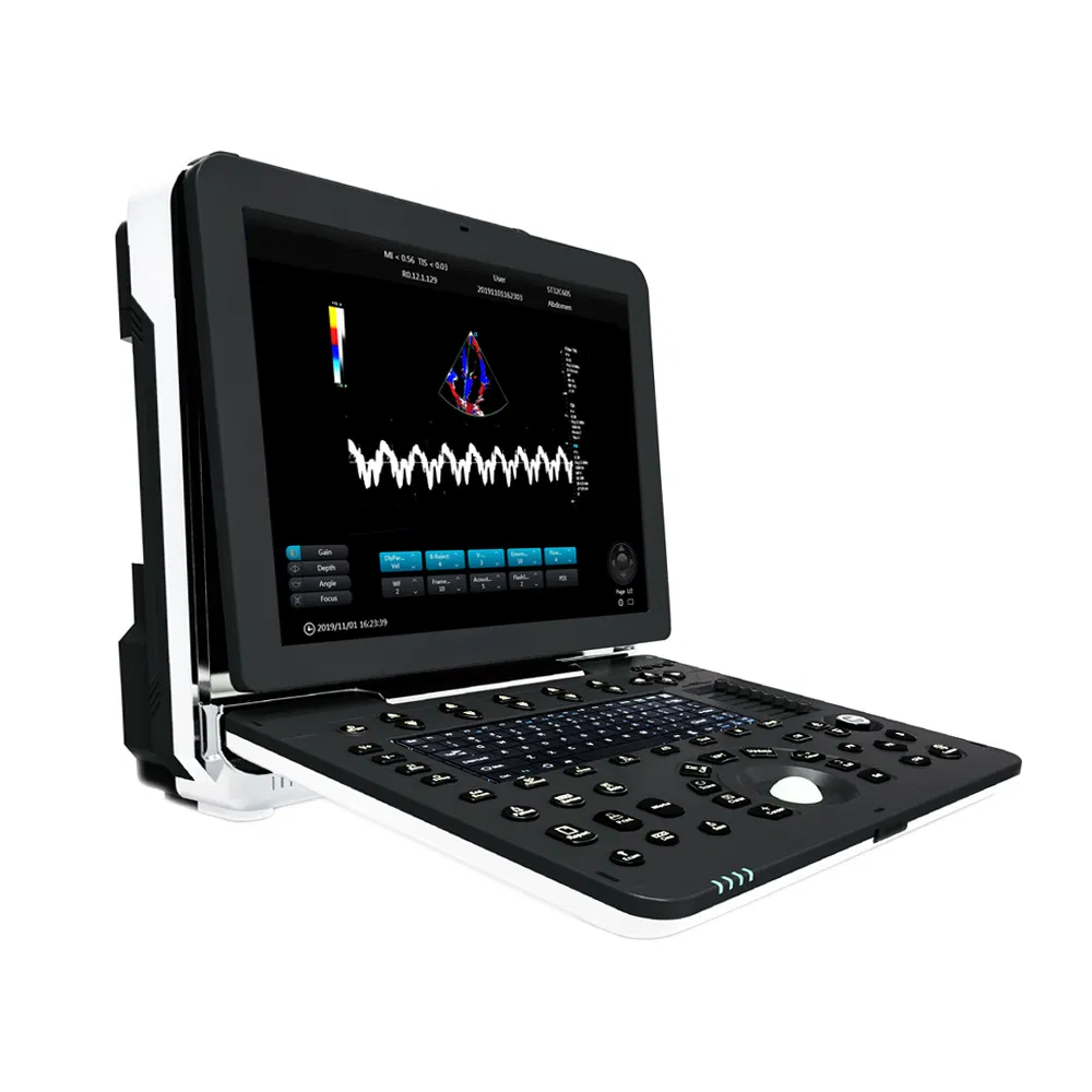 Ltub59 Sistema de ultrasonido cardíaco portátil de alta gama con alta configuración y color médico de alta venta