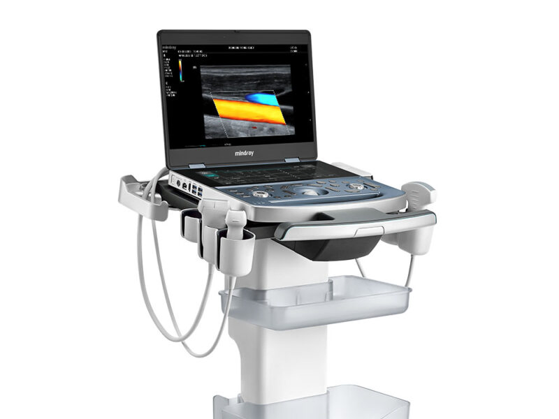 Mindray MX7 Máquina de Escáner Ultrasónico Portátil con Doppler Color 3D 4D