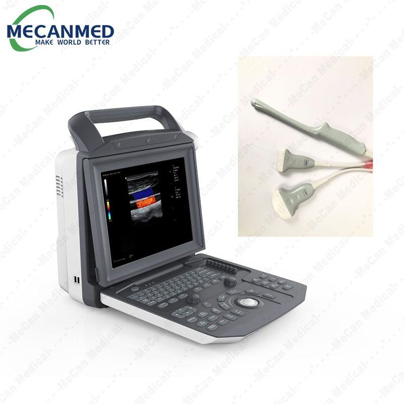 Escáner de ecocardiografía digital portátil completo, máquina de ultrasonido Doppler color portátil para embarazo