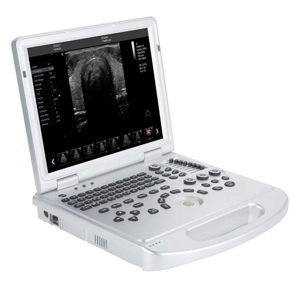 Máquina de ultrasonido médico portátil con Doppler color digital para el embarazo 3D/4D