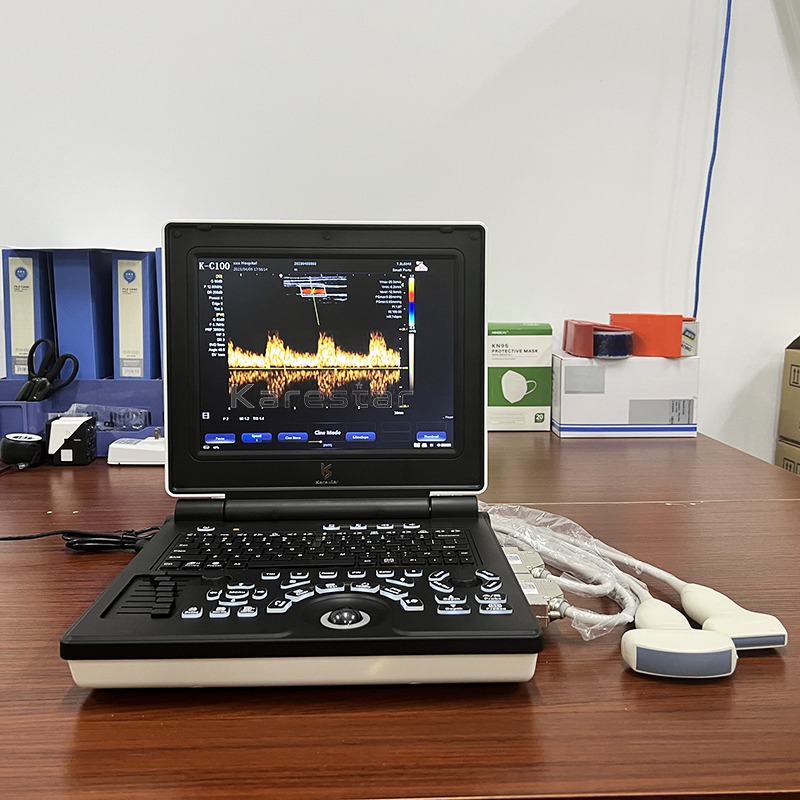 3D 4D Máquina de ultrasonido portátil con Doppler color