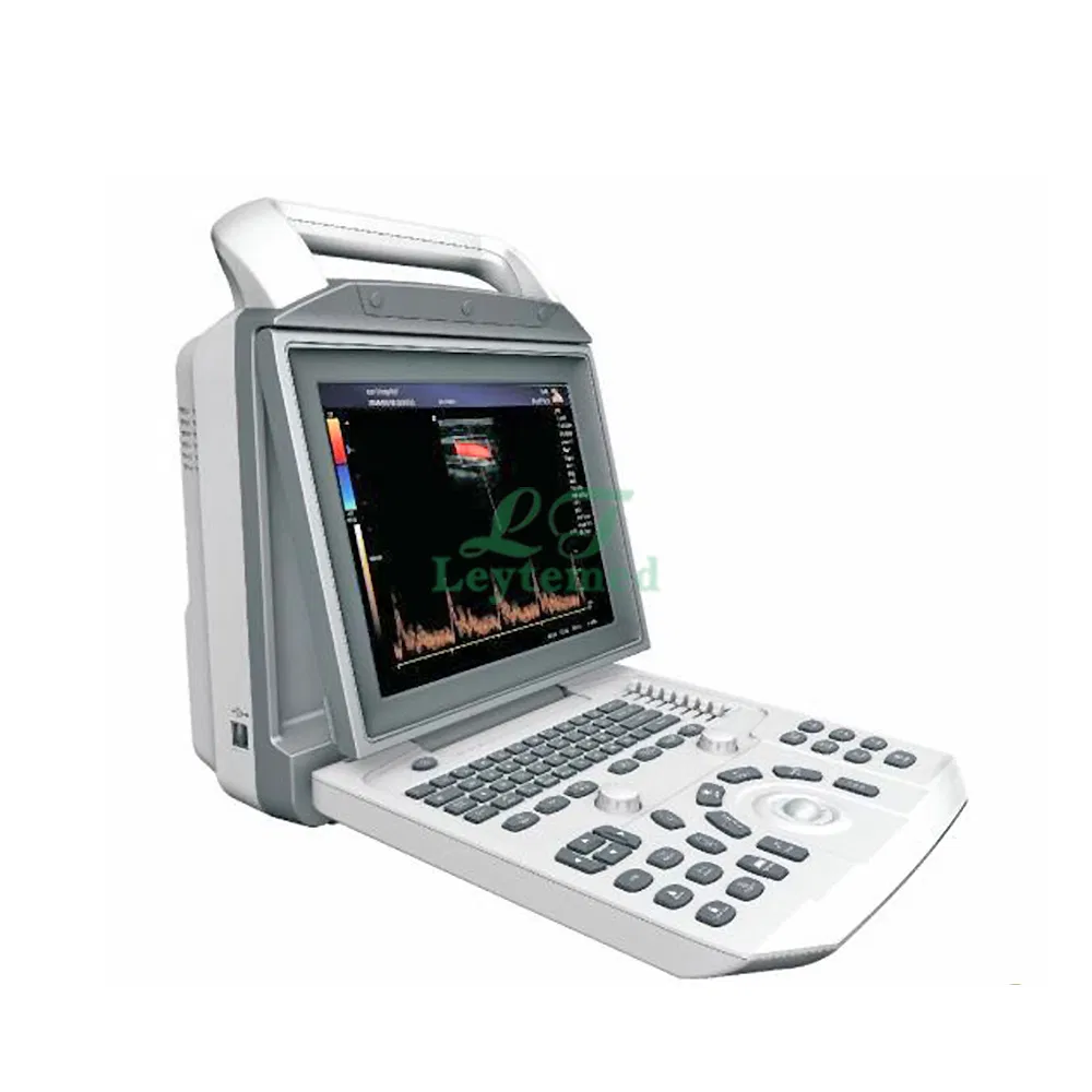 Ltub06 Todo Sistema de Diagnóstico Cardíaco Abdominal Digital por Ultrasonido con Doppler Color