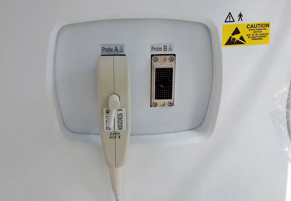 Ultrasónido Vista 4