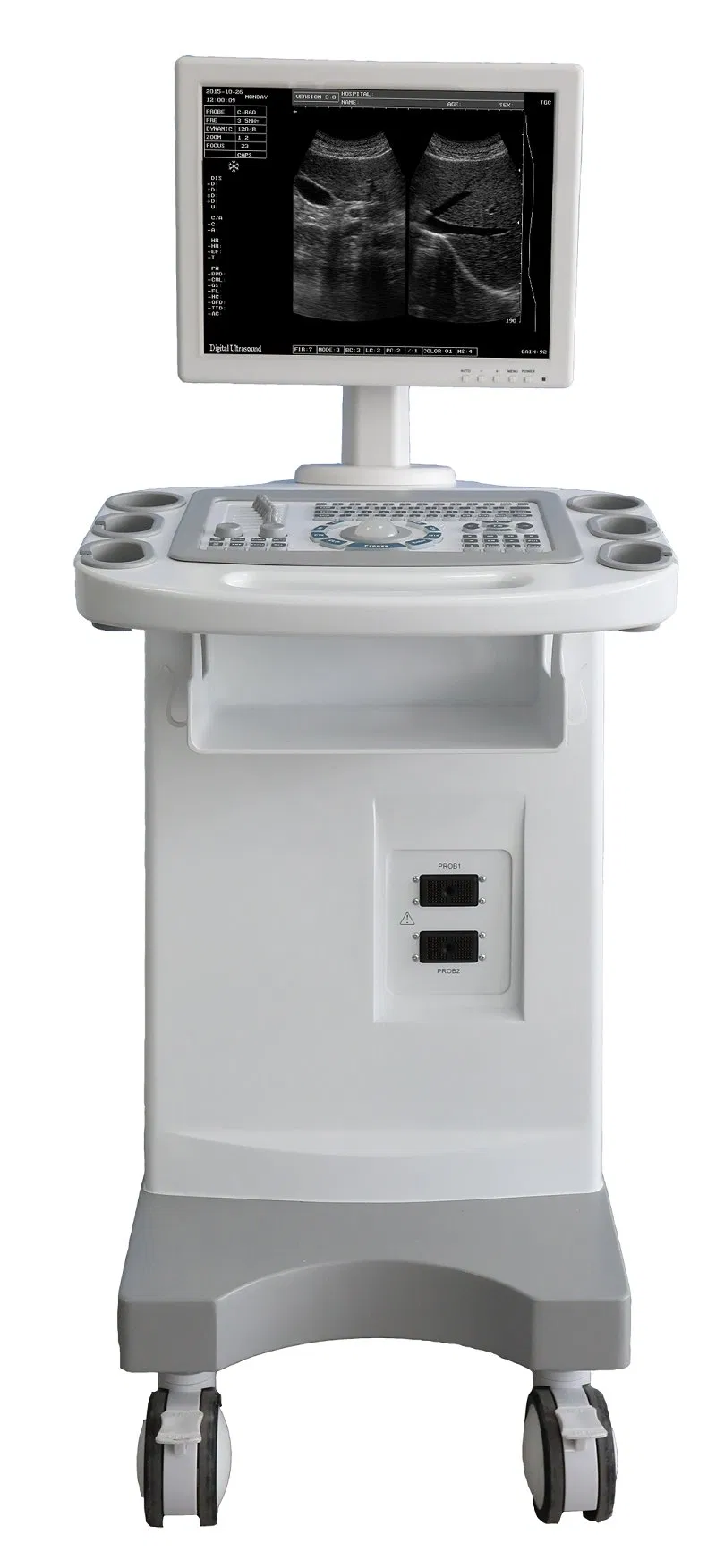 Carro de máquina de ultrasonido digital completo en blanco y negro para equipos hospitalarios
