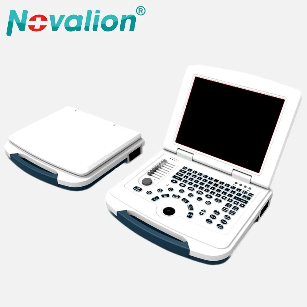 Precio de fábrica al por mayor Nl060701004A 12.1 Pulgadas Pantalla Médica 2D Máquina de Ultrasonido Portátil en Blanco y Negro