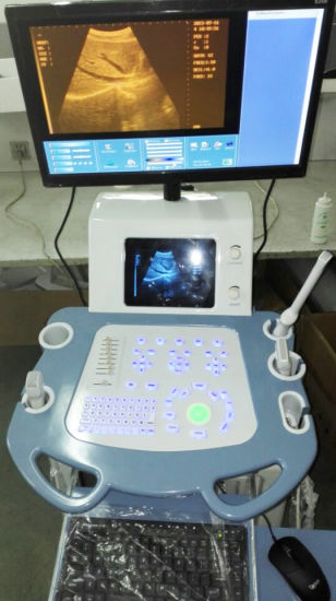 Sistema de Imagen Ultrasónica Digital de Alta Calidad (THR-US8800)