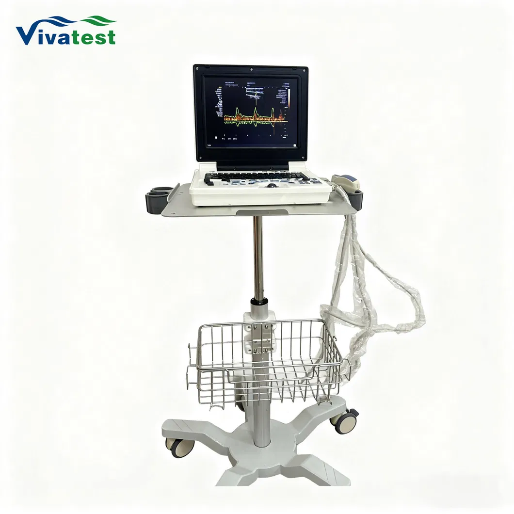 Diagnóstico por ultrasonido Doppler 2