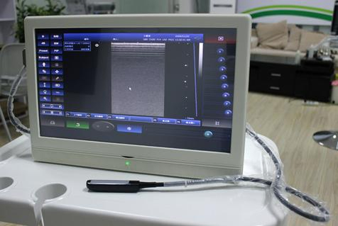 Escáner de ultrasonido portátil de alta frecuencia de diseño atractivo y popular, precio para Msk, nervio vascular 15MHz B36