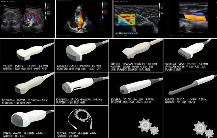 Sistema de ultrasonido Doppler color 1