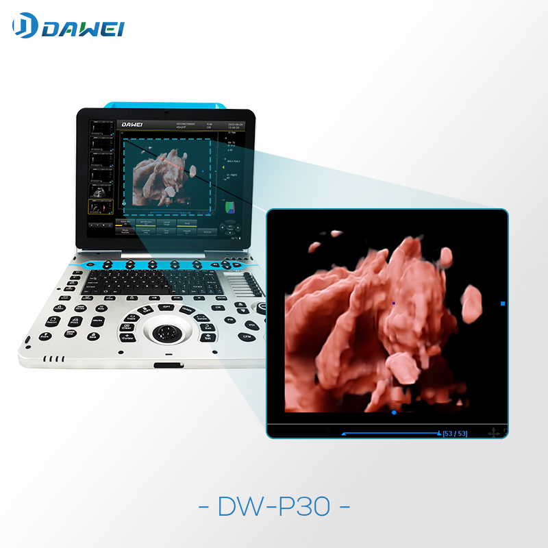 Máquina Médica de Ultrasonido Color Portable Doppler3d 4D
