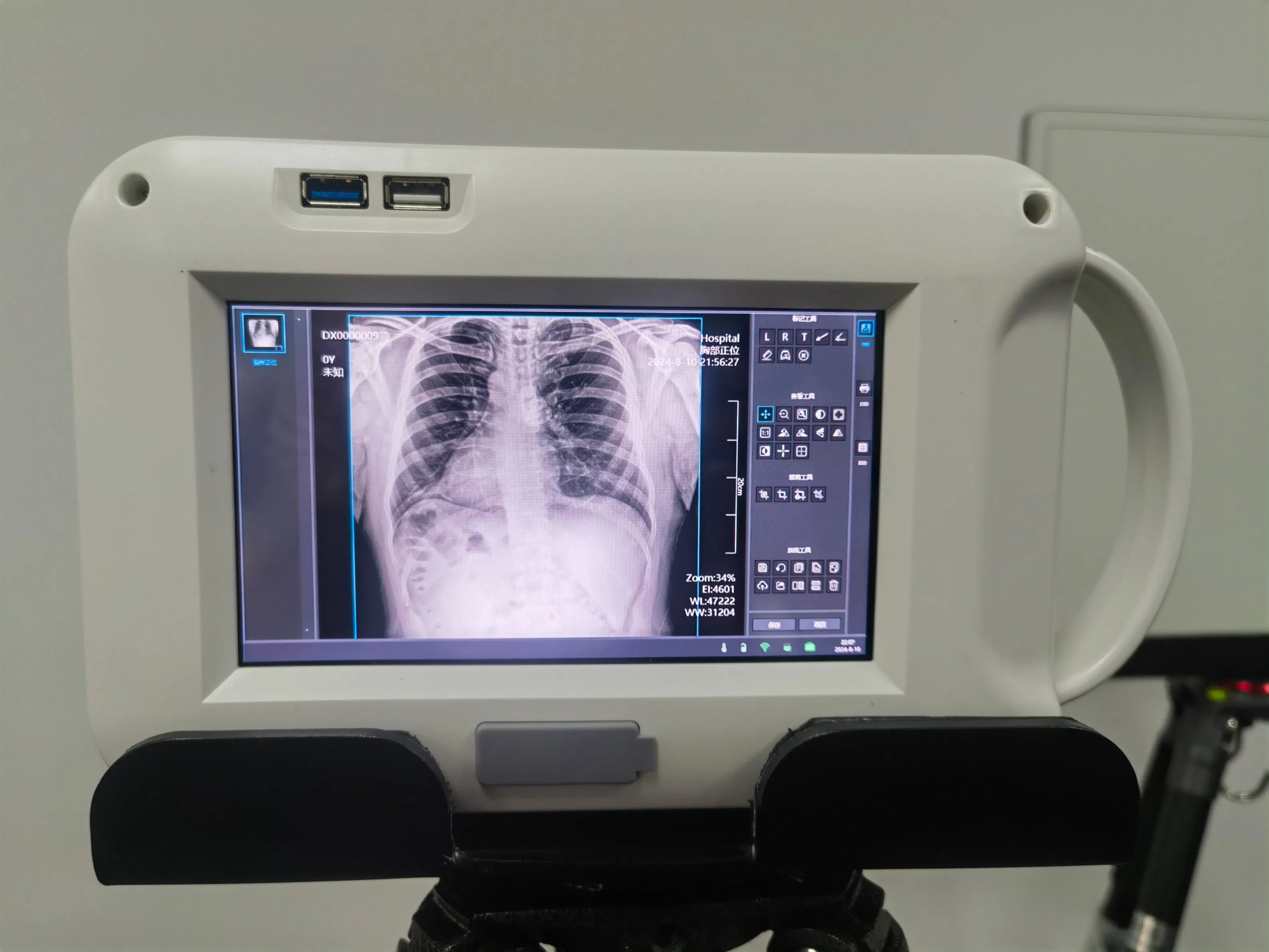 in-D705 Máquina de rayos X Escáner ultrasónico portátil Laboratorio Hospital Instrumento quirúrgico Diagnóstico Equipo médico oftálmico Proveedor