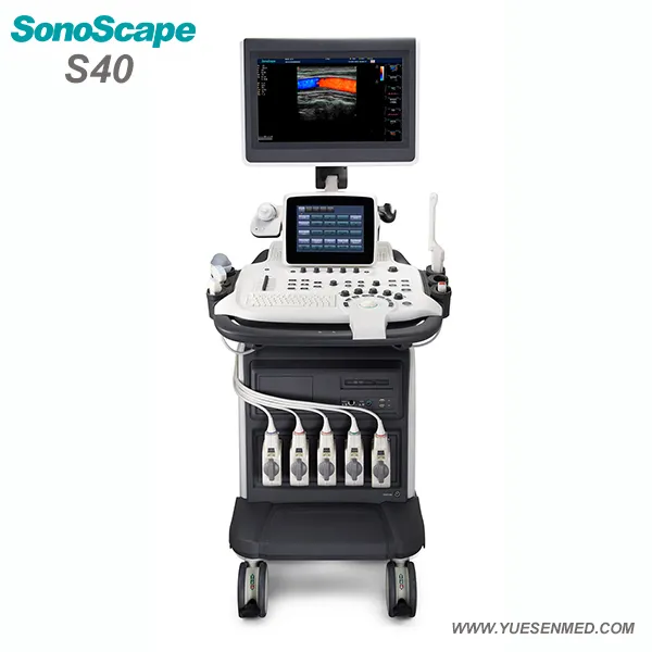 S40 3D 4D del sistema de ultrasonido doppler color