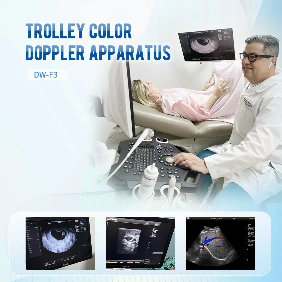 Nuevo Dw-F3 Carro de Ultrasonido Doppler Color Estacionario General
