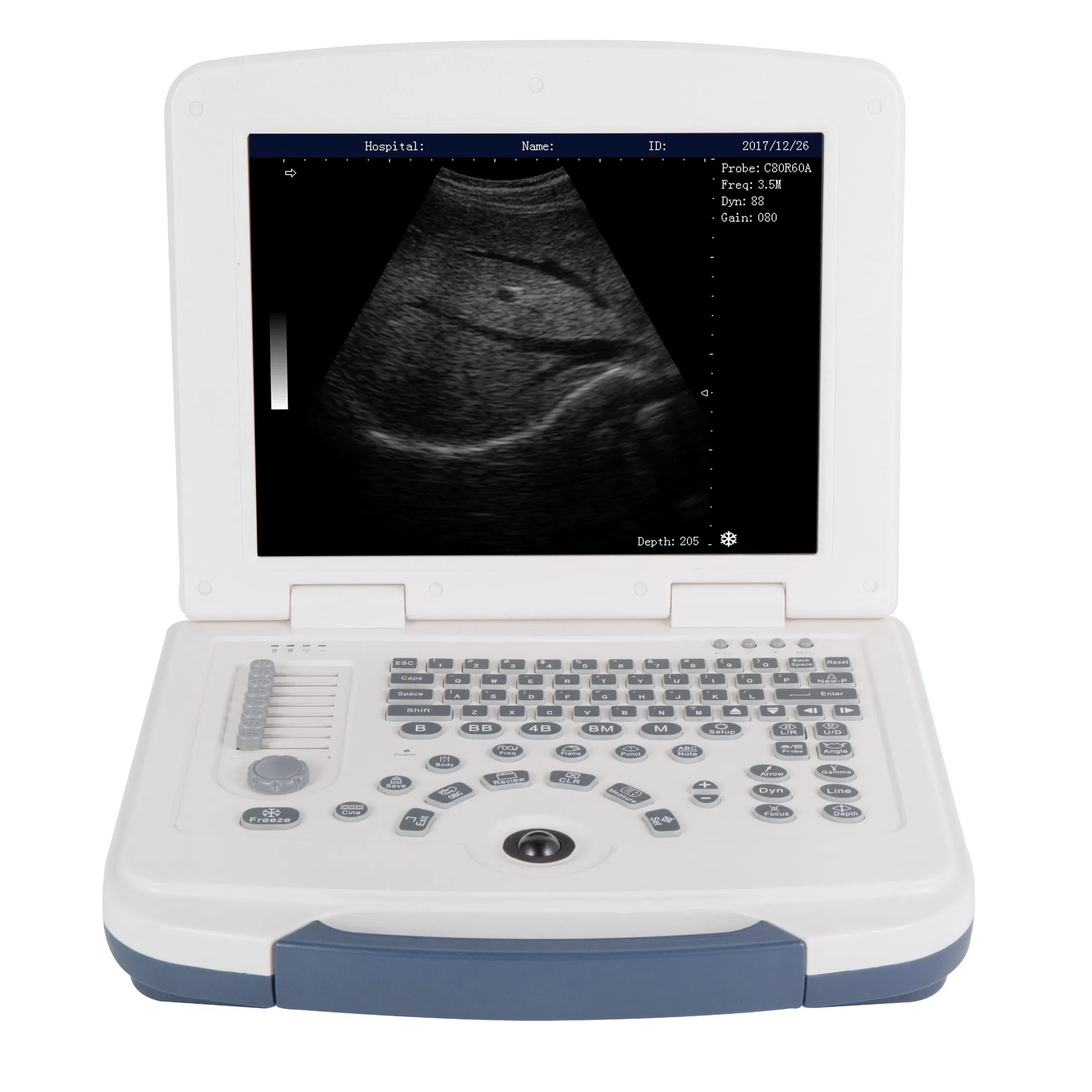 Escáner Ultrasónico Digital Portátil en Blanco y Negro Dawei Dw-580 Médico