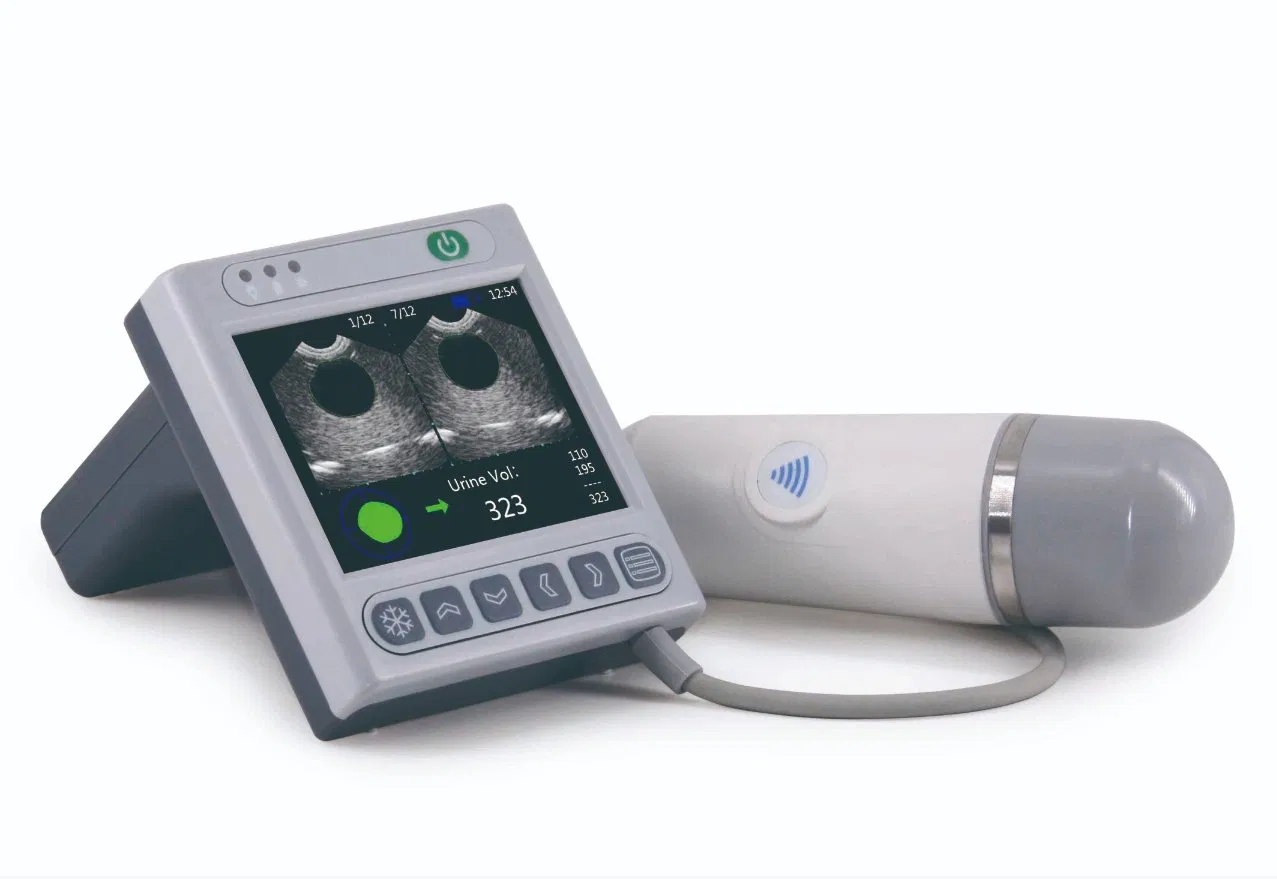 Escáner de ultrasonido de vejiga portátil, sistema de escaneo de volumen de vejiga