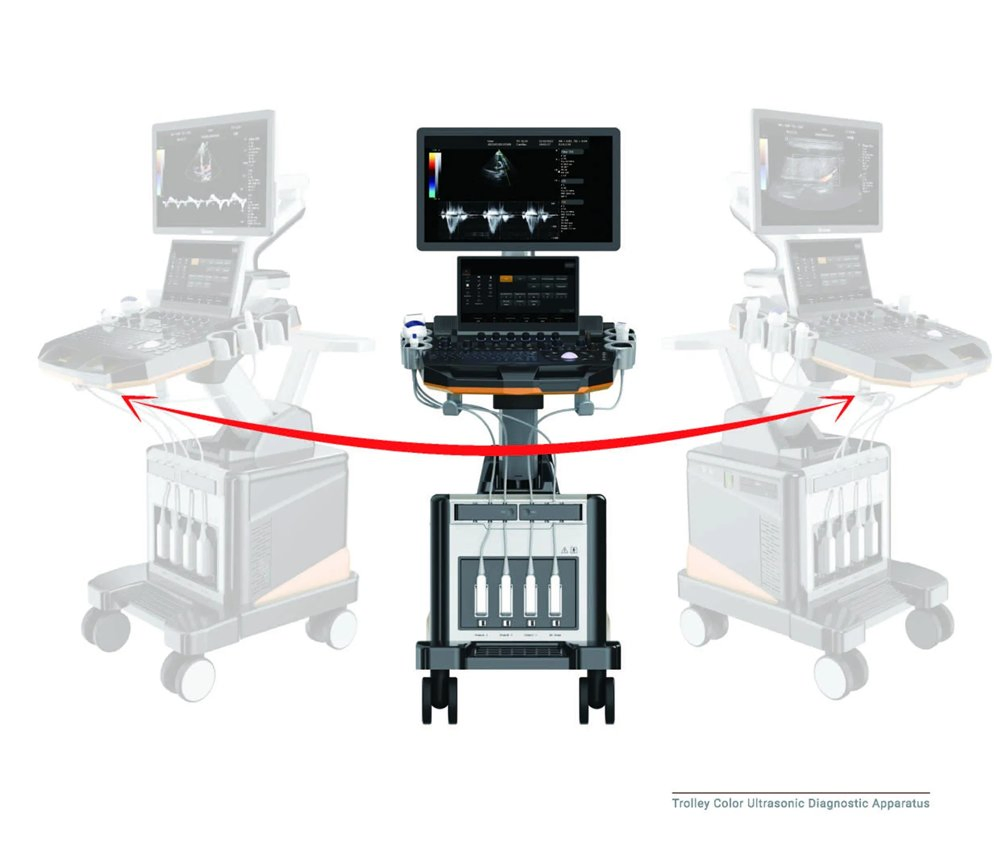Sistema de Ultrasonido Avanzado 3D/4D con Doppler Color - Máquina de Imágenes Médicas