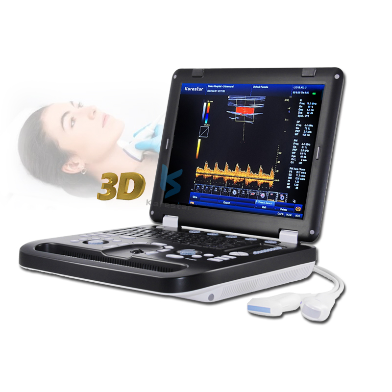 3D 4D Máquina de Ultrasonido Doppler Color Vascular Cardíaco Precio
