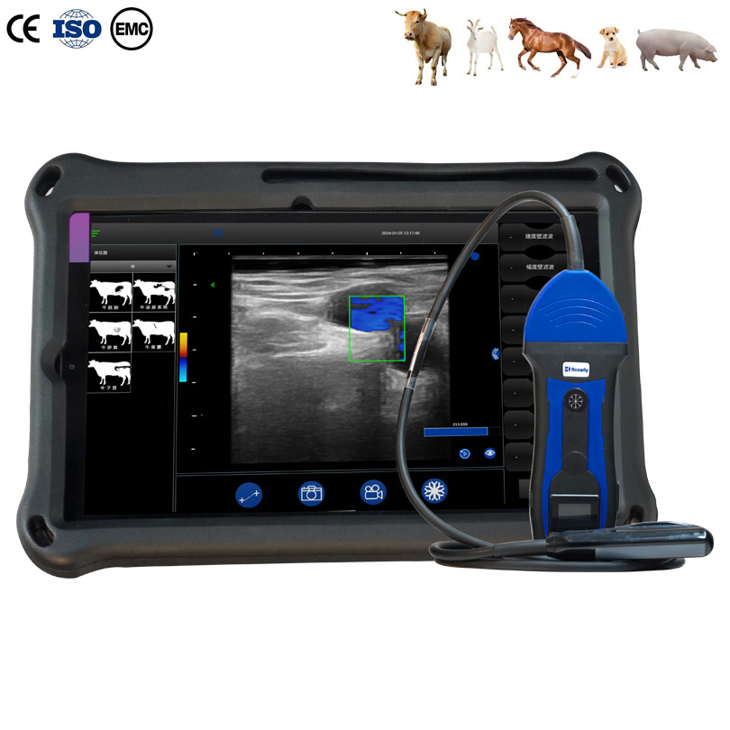 Bxl-S200 Máquina de Doppler Vascular Portátil Inalámbrica Máquina de Ultrasonido Portátil