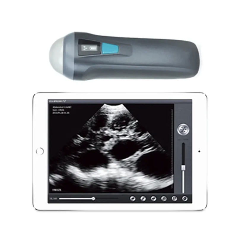 Escáner ultrasónico portátil inalámbrico mini (THR-CDC1)