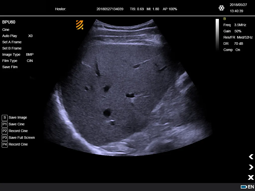 Ultrasonido Doppler Color 10