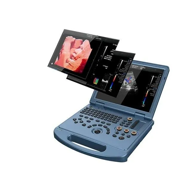 Ultrasonido Portátil