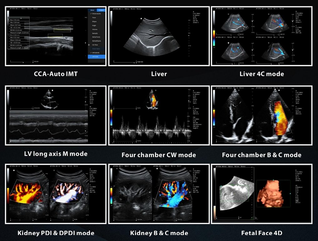 Sya-N7 Abdomen, Cardíaco 3D/4D Sistema de Ultrasonido Doppler Color con Carro