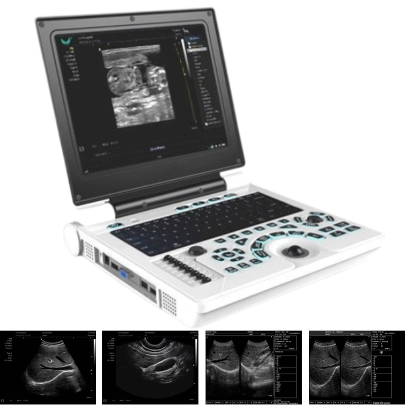 Máquina de escáner ultrasónico portátil Bw para hospital Xf30b con obstetricia y ginecología