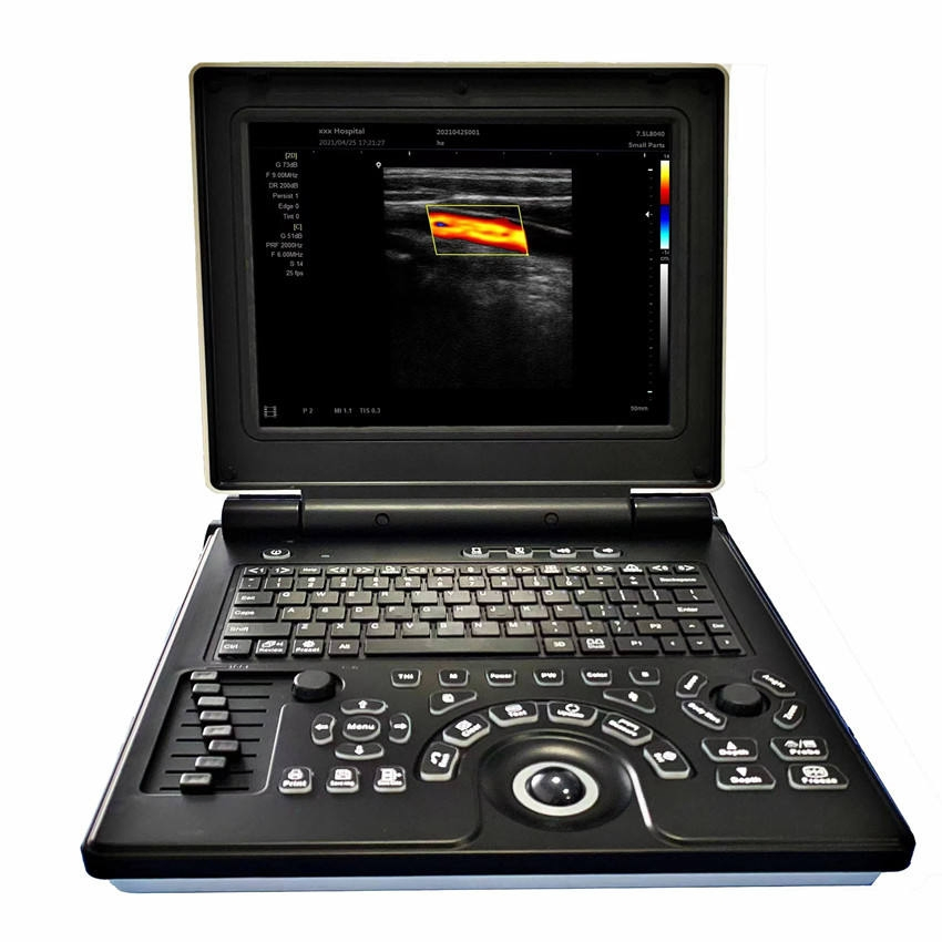 3D 4D Sistema de Ultrasonido Cardíaco Portátil Ecógrafo Color Doppler Laptop