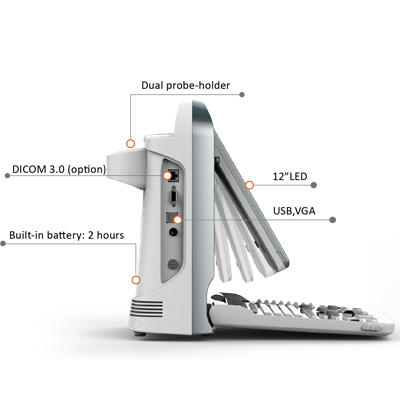 Máquina de ultrasonido portátil Doppler color LED de Chison Medical