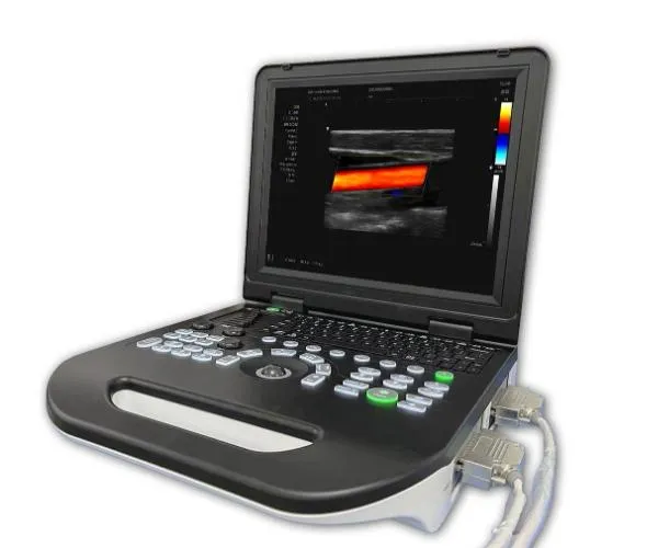 Doppler Color