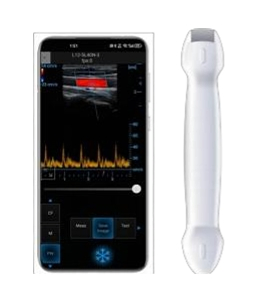 Máquina de ultrasonido portátil a color Doppler inalámbrica de alta calidad