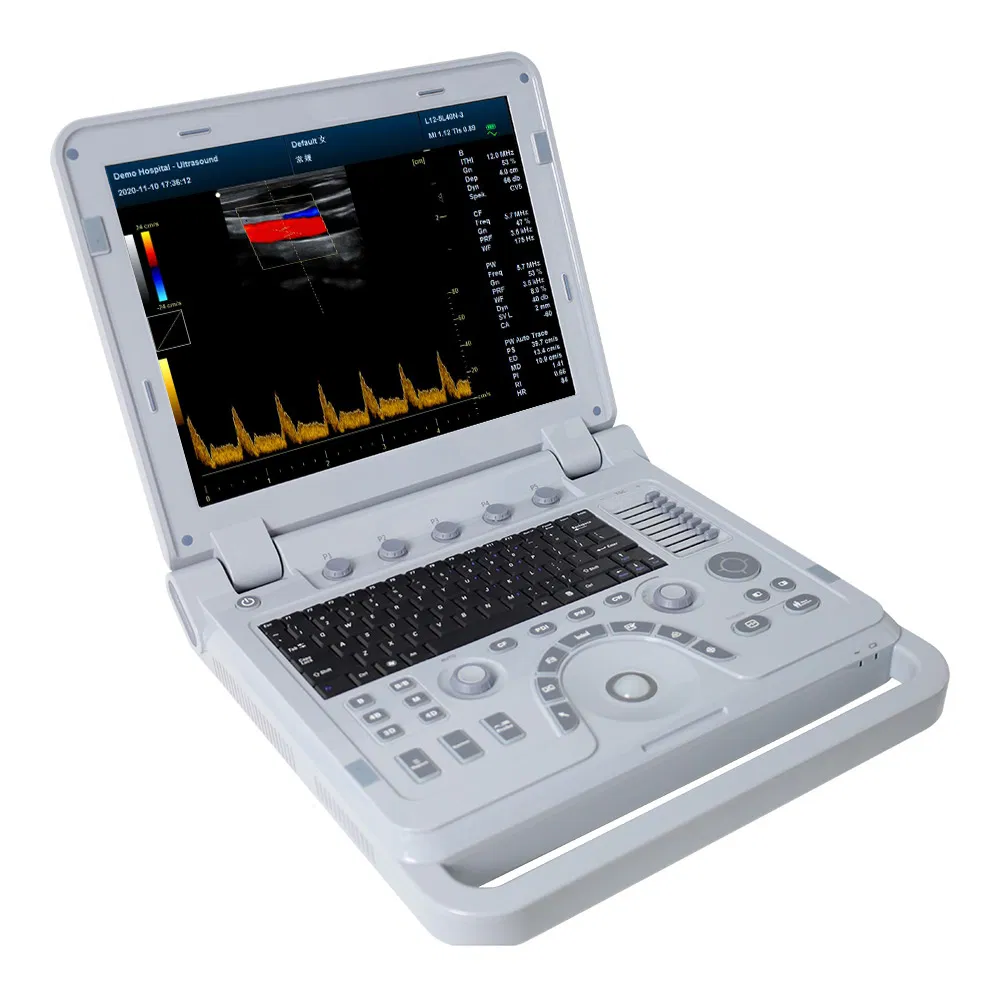 Máquina de Ultrasonido Veterinario Doppler Color Contec Cms1700b-Vet