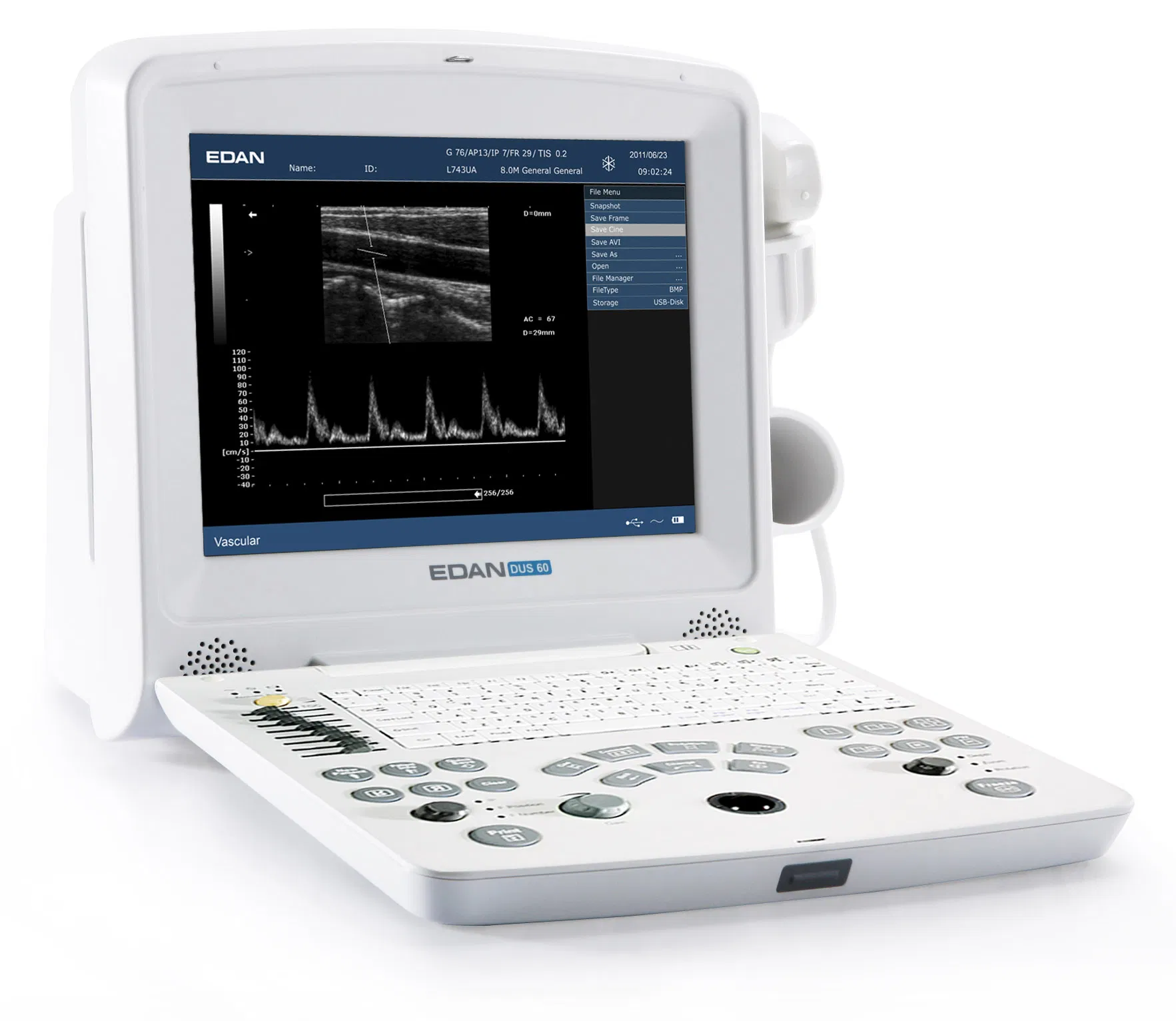 Edan Dus60 Máquina de Ultrasonido Portátil Veterinario en Venta Precio