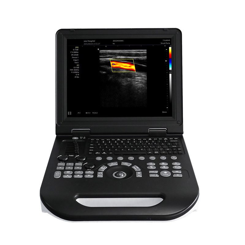Ucd30e Fabricante de China Precio Bajo Portátil Laptop Doppler 3D Máquina de Sistema de Ultrasonido