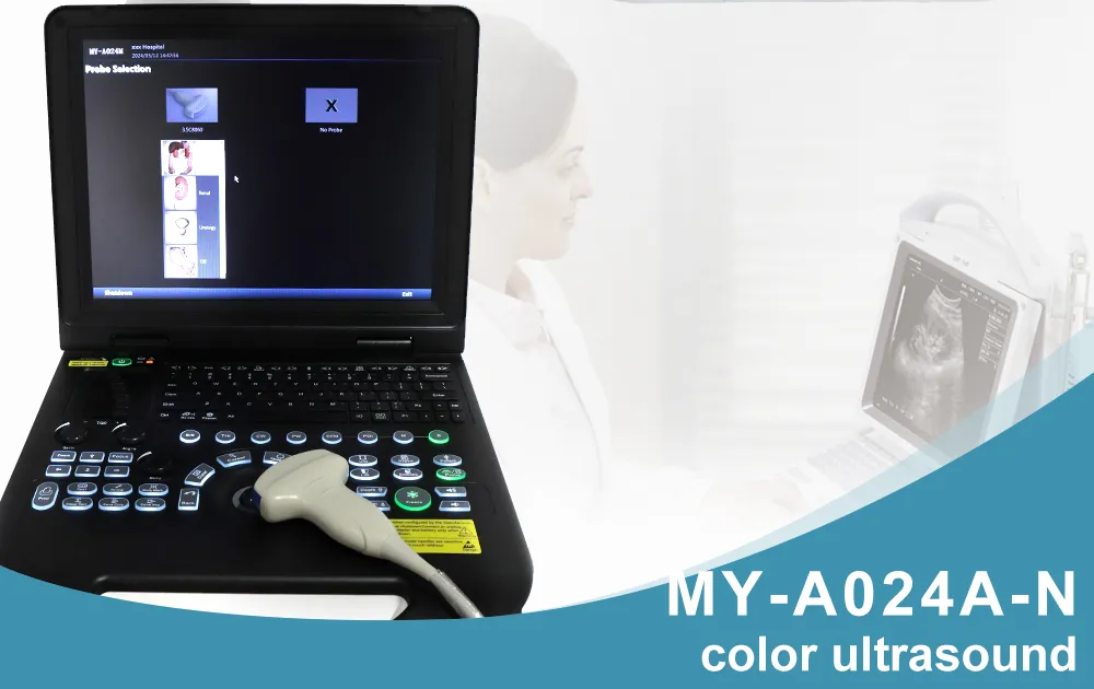 Sistema de Ultrasonido Doppler Color - Vista Frontal