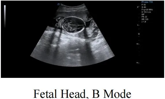 Imagen cardiaca