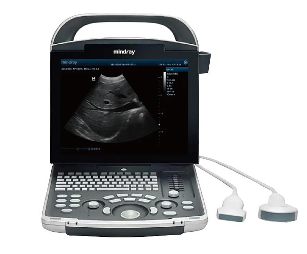 Ultrasuono Portátil DP-30 Vista