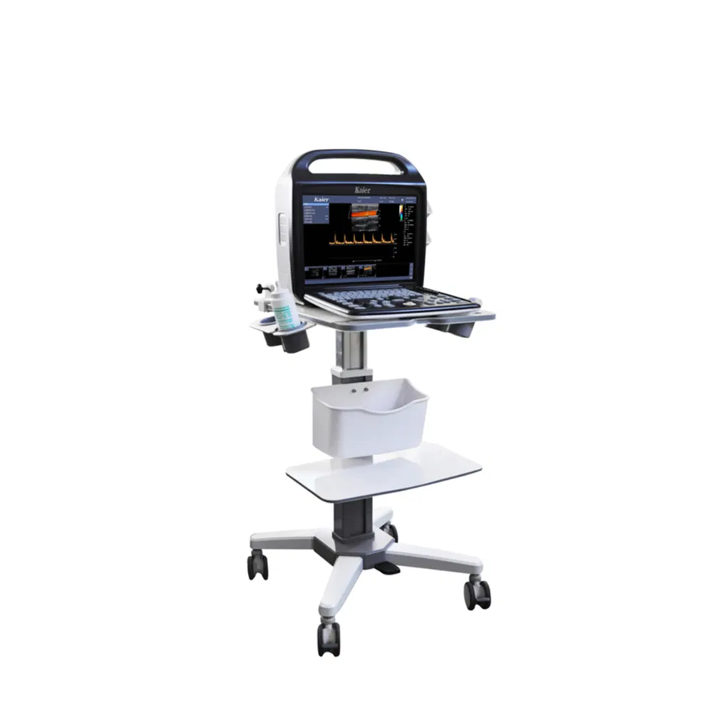 Sistema de Diagnóstico por Ultrasonido Doppler Color C80