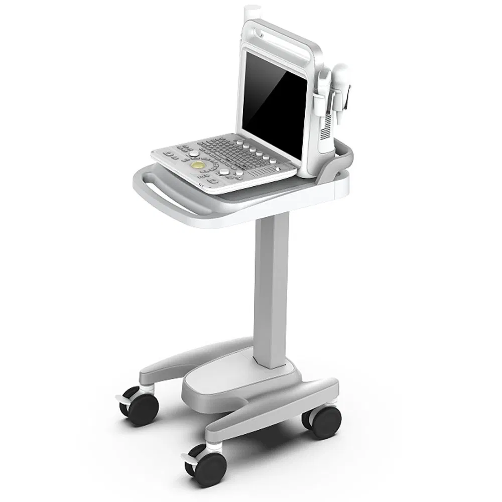 Sistema de ultrasonido avanzado de imagen por flujo de color digital con sonda convexa y imagen Doppler