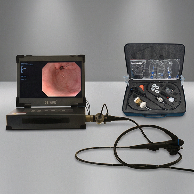Diagnostic Gastroscope Video Endoscope Endoscopy Instrument Imaging System for Surgery Examination