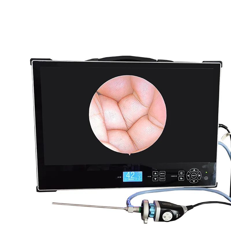 Endoscopic Imaging System