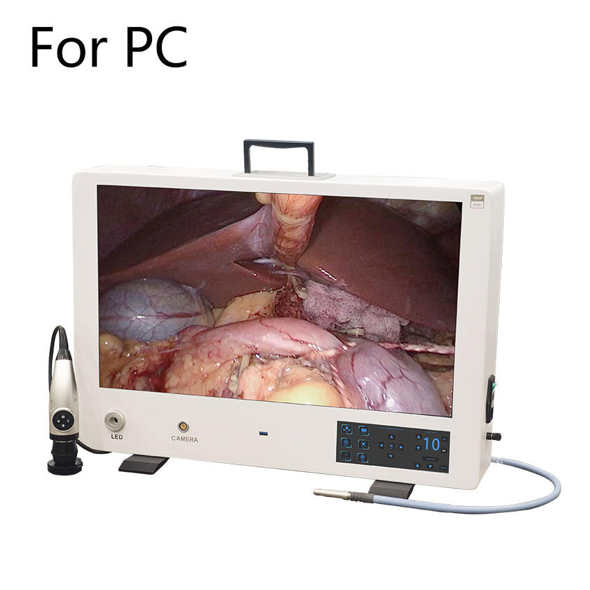 High-Definition Ureteroscope Camera System for Flexible Endoscopy