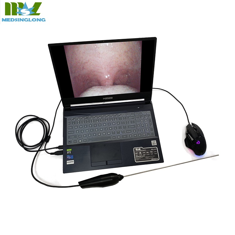Portable Video Fiber Optic Pediatric Sigmoidoscope Endoscopy Equipment