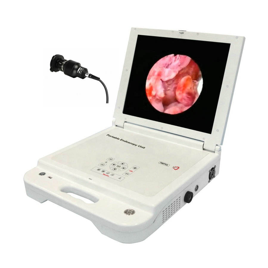 High Quality Ent Video Endoscopy Machine Instruments Camera System