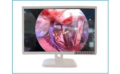 Endoscope Camera System 1