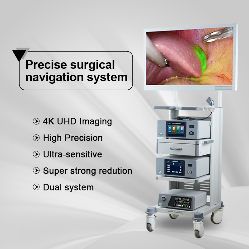 4K Video Camera Endoscopy System for Laparoscopic Surgery