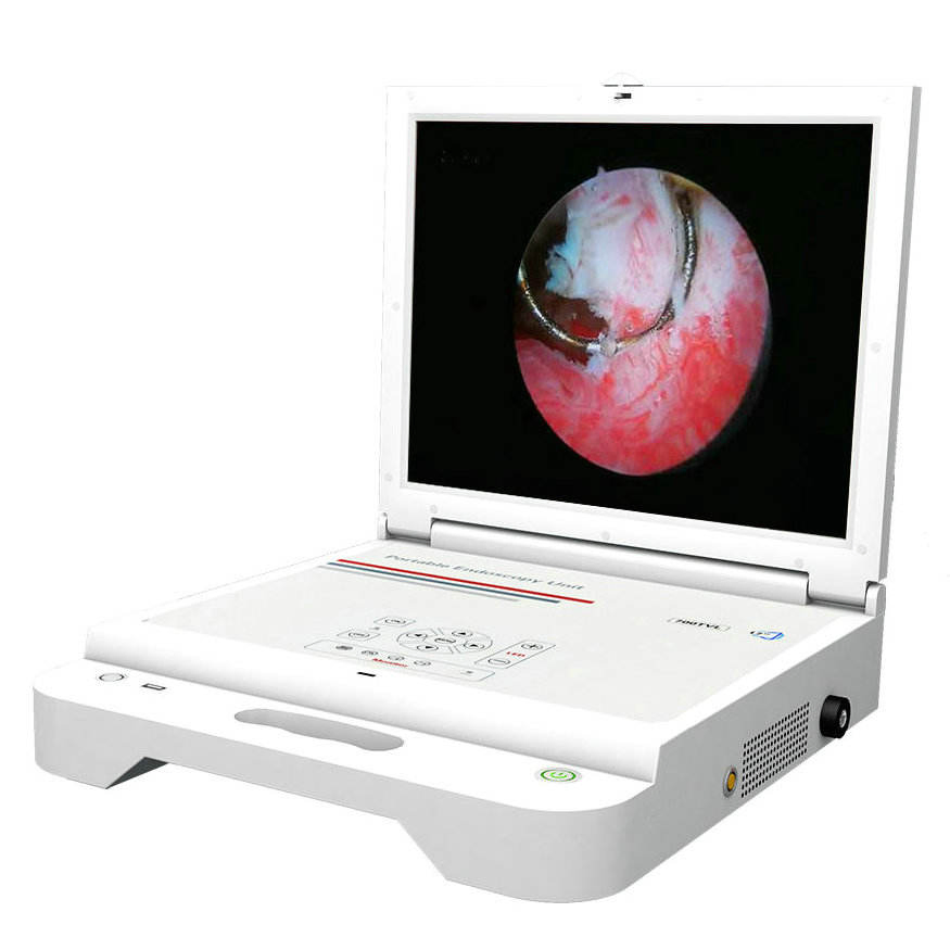 High Quality Ent Video Endoscopy Machine Instruments Camera System
