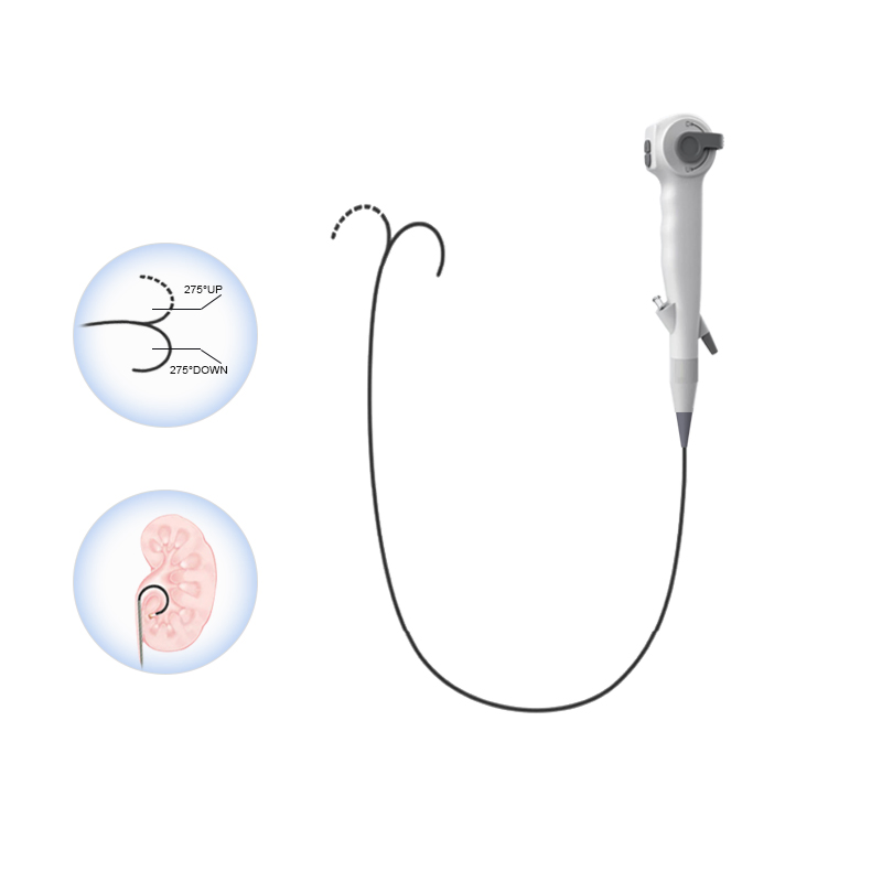 Geiwre High Quality Medical Flexible Endoscopy Camera System